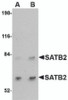 Western blot analysis of SATB2 in A20 cell lysate with SATB2 antibody at (A) 2 and (B) 4 &#956;g/mL.