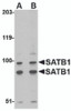 Western blot analysis of SATB1 in A20 cell lysate with SATB1 antibody at (A) 2 and (B) 4 &#956;g/mL.