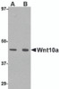 Western blot analysis of Wnt10a in RAW264.7 cell lysate with Wnt10a antibody at (A) 1 and (B) 2 &#956;g/mL.