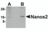 Western blot analysis of Nanos2 in human testis lyate with Nanos2 antibody at (A) 2 and (B) 4 &#956;g/mL.