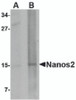 Western blot analysis of Nanos2 in rat brain tissue lysate with Nanos2 antibody at (A) 1 and (B) 2 &#956;g/mL.