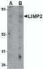Western blot analysis of LIMP2 in human skeletal muscle tissue lysate with LIMP2 antibody at (A) 1 and (B) 2 &#956;g/mL.