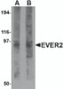 Western blot analysis of EVER2 in rat thymus tissue lysate with EVER2 antibody at (A) 1 and (B) 2 &#956;g/mL.