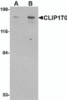 Western blot analysis of CLIP170 in rat brain tissue lysate with CLIP170 antibody at (A) 0.5 and (B) 1 &#956;g/mL.