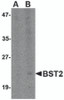 Western blot analysis of Bst2 in Daudi cell lysate with Bst2 antibody at (A) 1 and (B) 2 &#956;g/mL.