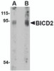 Western blot analysis of BICD2 in A549 cell lysate with BICD2 antibody at (A) 1 and (B) 2 &#956;g/mL.