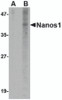 Western blot analysis of Nanos1 in SK-N-SH cell lysate with Nanos1 antibody at 1 &#956;g/mL in (A) the presence and (B) the absence of blocking peptide.