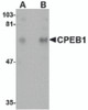 Western blot analysis of CPEB1 in rat brain tissue lysate with CPEB1 antibody at (A) 1 and (B) 2 &#956;g/mL.