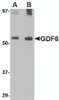 Western blot analysis of GDF6 in SK-N-SH lysate with GDF6 antibody at (A) 0.5 and (B) 1 &#956;g/mL.