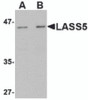 Western blot analysis of LASS5 in rat brain tissue lysate with LASS5 antibody at (A) 1 and (B) 2 &#956;g/mL.