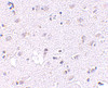 Immunohistochemistry of LASS5 in human brain tissue with LASS5 antibody at 2.5 ug/mL.