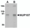 Western blot analysis of NUP107 in A549 cell lysate with NUP107 antibody at (A) 1 and (B) 2 &#956;g/mL.