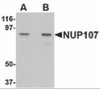 Western blot analysis of NUP107 in A549 cell lysate with NUP107 antibody at (A) 1 and (B) 2 &#956;g/mL.