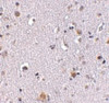 Immunohistochemistry of NUP160 in human brain tissue with NUP160 antibody at 2.5 ug/mL.