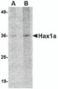 Western blot analysis of Hax1a in human brain tissue lysate with Hax1a antibody at (A) 1 and (B) 2 &#956;g/mL.