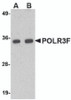 Western blot analysis of POLR3F in human brain tissue lysate with POLR3F antibody at (A) 0.5 and (B) 1 &#956;g/mL.