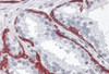 Immunohistochemistry of BMP15 in human prostate tissue with BMP15 antibody at 10 &#956;g/mL