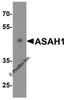 Western blot analysis of ASAH1 in human heart tissue lysate with ASAH1 antibody at 1 &#956;g/mL.
