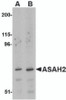 Western blot analysis of ASAH2 in 293 cell lysate with ASAH2 antibody at (A) 1 and (B) 2 &#956;g/mL.