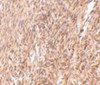 Immunohistochemistry of TRIM30 in mouse ovary tissue with TRIM30 antibody at 10 ug/mL.