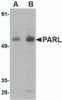 Western blot analysis of PARL in 3T3 cell lysate with PARL antibody at (A) 1 and (B) 2 &#956;g/mL.