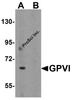 Western blot analysis of GPVI in K562 cell lysate with GPVI antibody at 1 &#956;g/mL in (A) the absence and (B) the presence of blocking peptide.