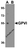 Western blot analysis of GPVI expression in Jurkat cell lysate with GPVI antibody at  1 &#956;g/ml in (A) the absence and (B) the presence of blocking peptide.