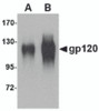 Western blot analysis of (A) 25 and (B) 100 ng of gp120 with gp120 antibody at 1 &#956;g/mL.