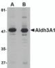 Western blot analysis of Aldh3A1 in human stomach lysate with Aldh3A1 antibody at (A) 1 and (B) 2 &#956;g/mL.