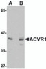 Western blot analysis of ACVR1 in A549 cell lysate with ACVR1 antibody at (A) 1 and (B) 2 &#956;g/mL.