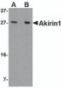 Western blot analysis of Akirin1 in A549 cell lysate with Akirin1 antibody at (A) 1 and (B) 2 &#956;g/mL.