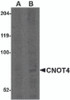 Western blot analysis of CNOT4 in A549 lysate with CNOT4 antibody at (A) 1 and (B) 2 &#956;g/mL.