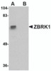 Western blot analysis of ZBRK1 in A-20 lysate with ZBRK1 antibody at 1 &#956;g/mL in (A) the absence and (B) the presence of blocking peptide.