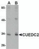 Western blot analysis of CUEDC2 in HeLa cell lysate with CUEDC2 antibody at (A) 1 and (B) 2 &#956;g/mL.
