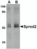 Western blot analysis of Spred2 in human small intestine tissue lysate with Spred2 antibody at (A) 1 and (B) 2 &#956;g/mL.