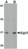 Western blot analysis of Aipl1 in human brain tissue lysate with Aipl1 antibody at (A) 1 and (B) 2 &#956;g/mL.