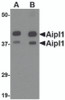 Western blot analysis of Aipl1 in rat brain tissue lysate with Aipl1 antibody at (A) 1 and (B) 2 &#956;g/mL.