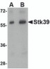 Western blot analysis of Stk39 in rat brain tissue lysate with Stk39 antibody at (A) 1 and (B) 2 &#956;g/mL.