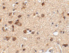 Immunohistochemistry of Stk39 in human brain tissue with Stk39 antibody at 2.5 ug/mL.