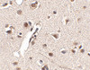 Immunohistochemistry of Rkhd4 in human brain tissue with Rkhd4 antibody at 2.5 ug/mL.