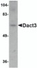 Western blot analysis of Dact3 in rat brain tissue lysate with Dact3 antibody at 1 &#956;g/mL.