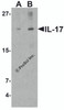 Figure 1 Western Blot Validation in Human THP-1 Cell Lysate
Loading: 15 &#956;g of lysates per lane.
Antibodies: IL-17 4877 (A: 1 &#956;g/mL and B: 2 &#956;g/mL) , 1h incubation at RT in 5% NFDM/TBST.
Secondary: Goat anti-rabbit IgG HRP conjugate at 1:10000 dilution.