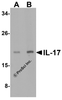 Figure 2 Western Blot Validation in A-20 Cell Lysate
Loading: 15 ug of lysates per lane.
Antibodies: IL-17 4877 (A: 2 ug/mL and B: 4 ug/mL) , 1h incubation at RT in 5% NFDM/TBST.
Secondary: Goat anti-rabbit IgG HRP conjugate at 1:10000 dilution.