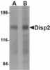 Western blot analysis of Disp2 in rat brain tissue lysate with Disp2 antibody at (A) 1 and (B) 2 &#956;g/mL.