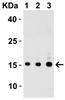 Figure 1 Western Blot Validation with Recombinant Protein
Loading: 30 ng of human IL-17 recombinant protein per lane.
Antibodies: IL-17 4887, 1h incubation at RT in 5% NFDM/TBST.
Secondary: Goat anti-rabbit IgG HRP conjugate at 1:10000 dilution.
Lane 1: 0.125 &#956;g/mL
Lane 2: 0.25 &#956;g/mL
Lane 3: 0.5 &#956;g/mL