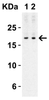 Figure 2 Western Blot Validation with Human Spleen 
Loading: 10 ug of lysates per lane.
Antibodies: IL-17 4887, 1h incubation at RT in 5% NFDM/TBST.
Secondary: Goat anti-rabbit IgG HRP conjugate at 1:10000 dilution.
Exposure: 1 min
Lane 1: 1 ug/mL 
Lane 2: 2 ug/mL