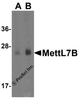 Western blot analysis of MettL7B in human colon tissue lysate with MettL7B antibody at (A) 1 and (B) 2 &#956;g/mL.