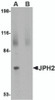 Western blot analysis of JPH2 in 293 cell lysate with JPH2 antibody at 2 &#956;g/mL in (A) the absence and (B) the presence of blocking peptide.