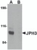 Western blot analysis of JPH3 in Daudi cell lysate with JPH3 antibody at 1 &#956;g/mL in (A) the absence and (B) the presence of blocking peptide.