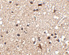 Immunohistochemistry of JPH3 in human brain tissue with JPH3 antibody at 2.5 ug/mL.